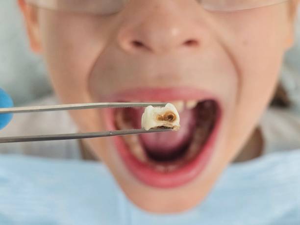 Best Cracked Tooth Emergency Dentist  in Emigsville, PA